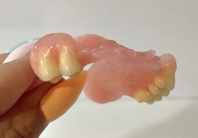 جایگزینی چند دندان از دست‌رفته