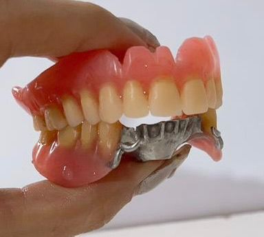 تعمیر فوری دندان‌های مصنوعی