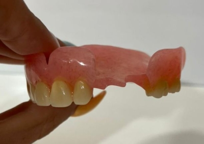 بازسازی و نوسازی پروتزهای قدیمی