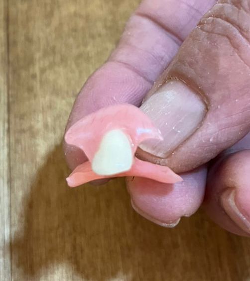 نامی آشنا در دندانسازی تهرانپارس